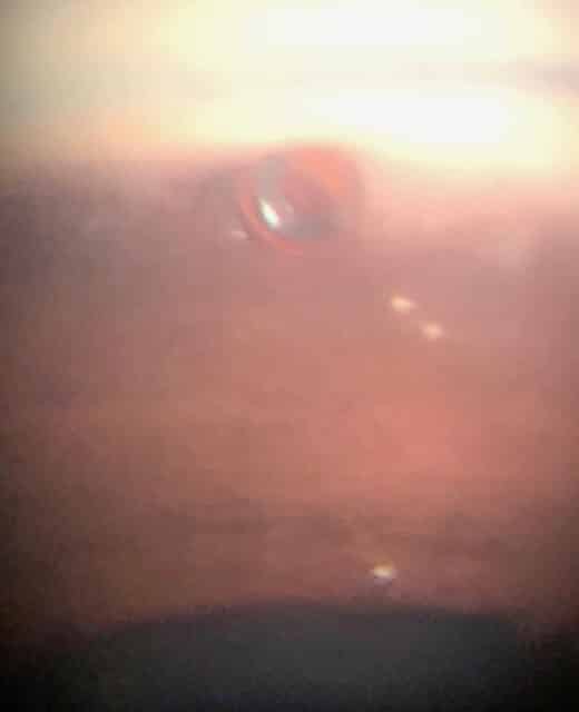 Cypass Microstent